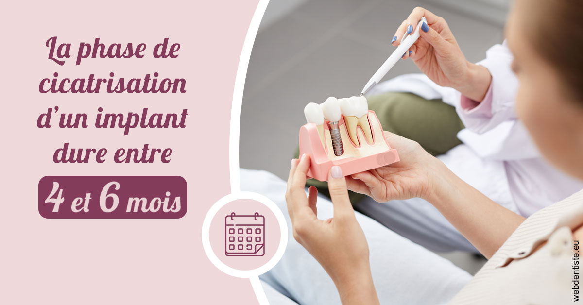 https://dr-carroy-frederic.chirurgiens-dentistes.fr/Cicatrisation implant 2