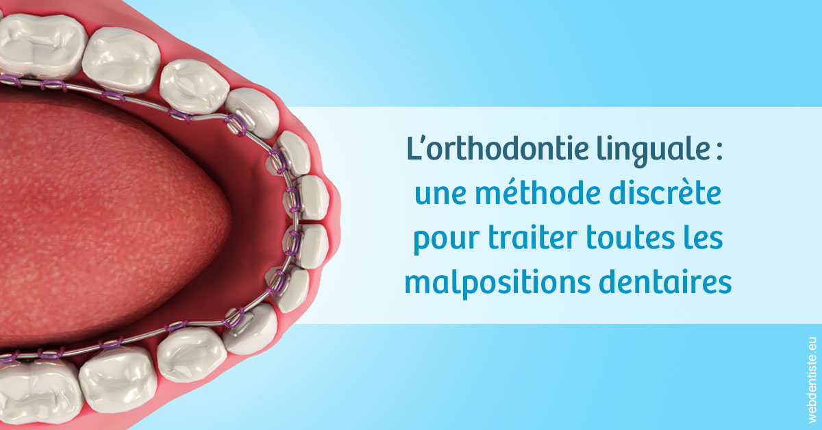 https://dr-carroy-frederic.chirurgiens-dentistes.fr/L'orthodontie linguale 1