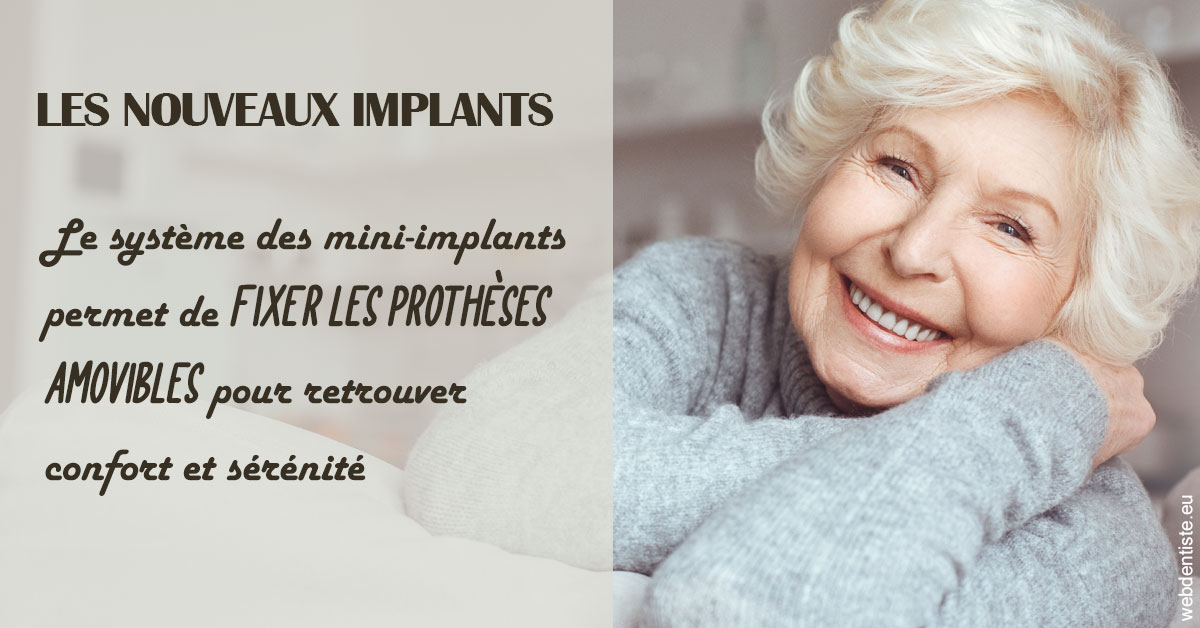 https://dr-carroy-frederic.chirurgiens-dentistes.fr/Les nouveaux implants 1