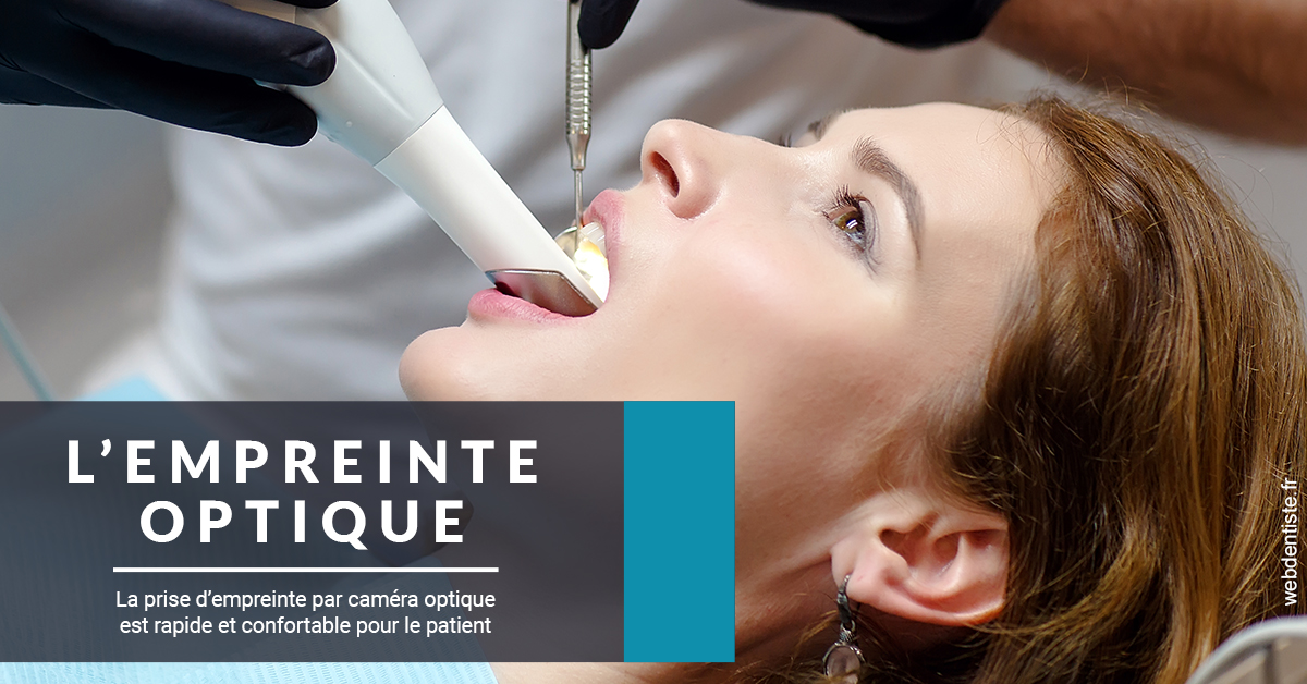 https://dr-carroy-frederic.chirurgiens-dentistes.fr/L'empreinte Optique 1