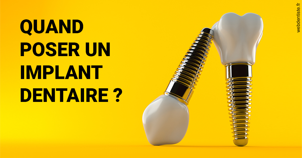 https://dr-carroy-frederic.chirurgiens-dentistes.fr/Les implants 2
