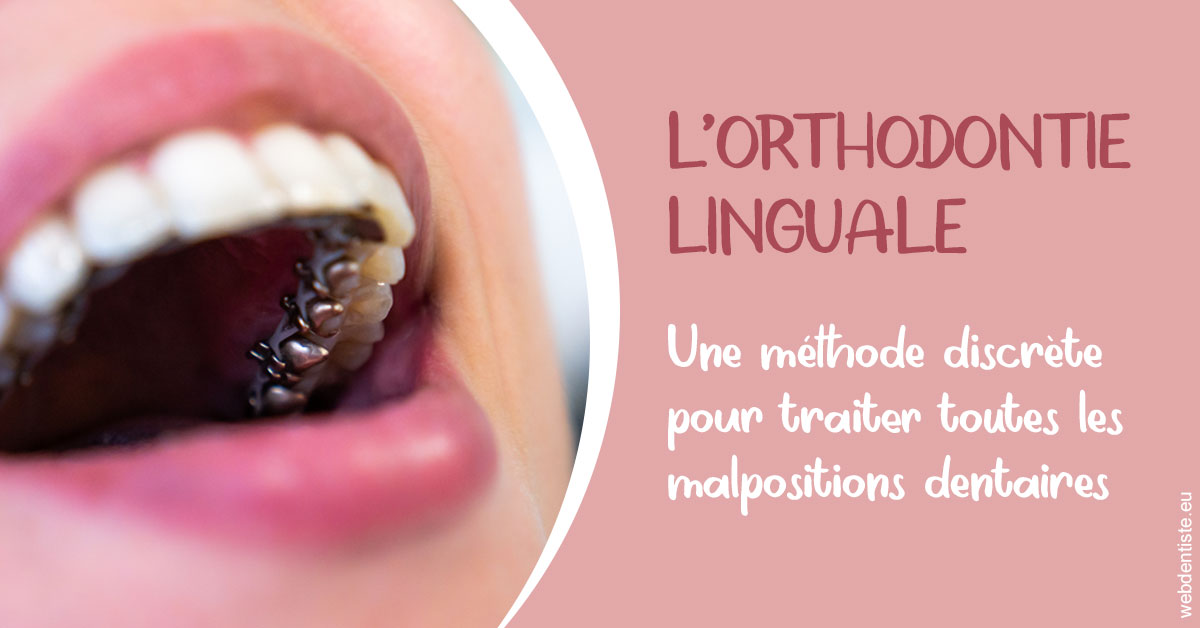 https://dr-carroy-frederic.chirurgiens-dentistes.fr/L'orthodontie linguale 2