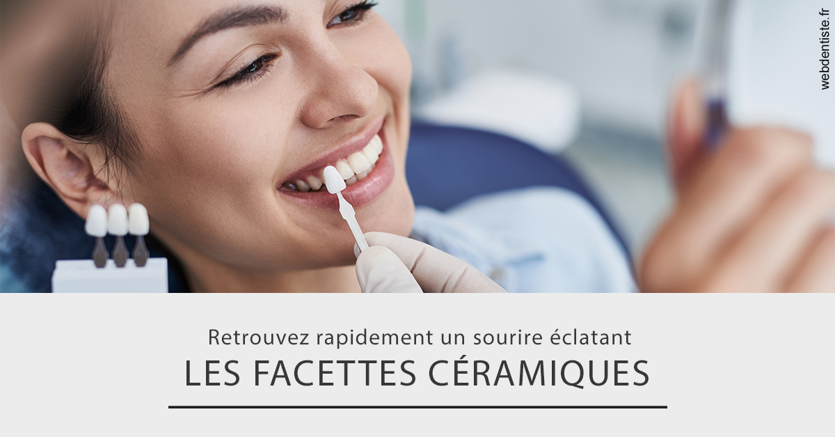 https://dr-carroy-frederic.chirurgiens-dentistes.fr/Les facettes céramiques 2