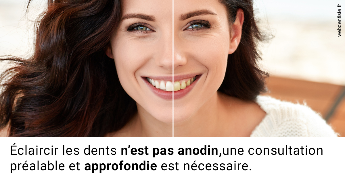 https://dr-carroy-frederic.chirurgiens-dentistes.fr/Le blanchiment 2