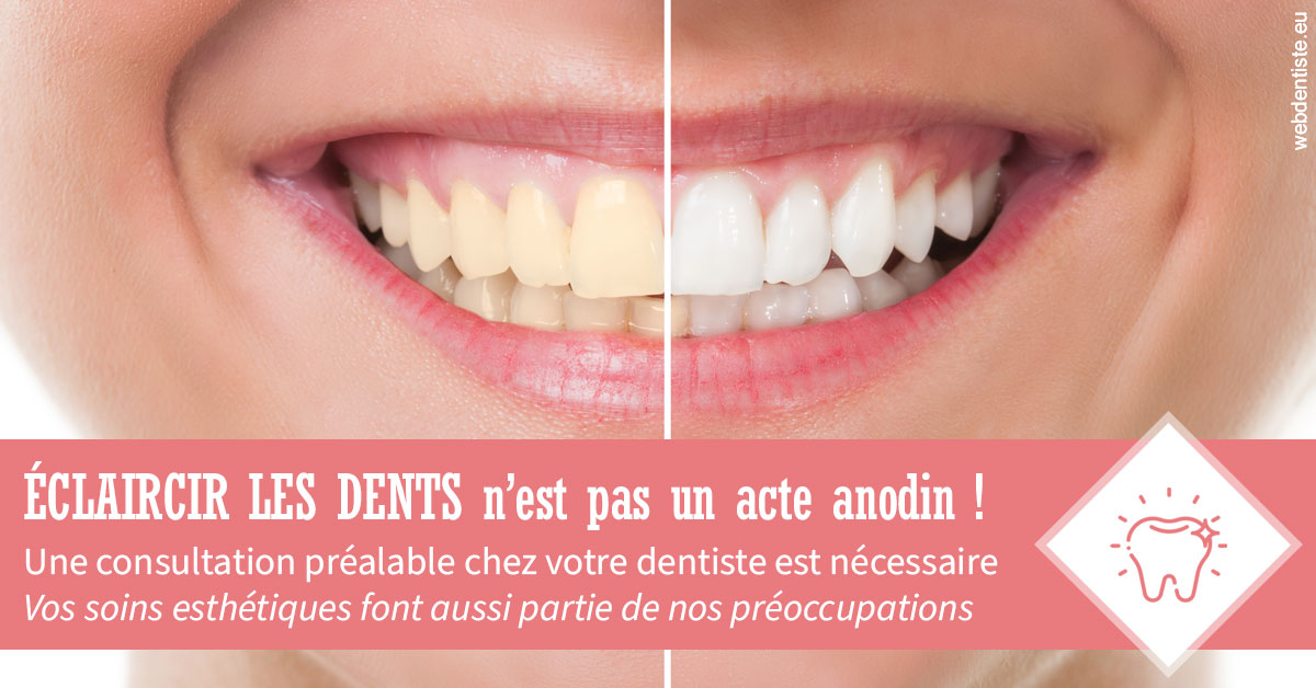 https://dr-carroy-frederic.chirurgiens-dentistes.fr/Eclaircir les dents 1
