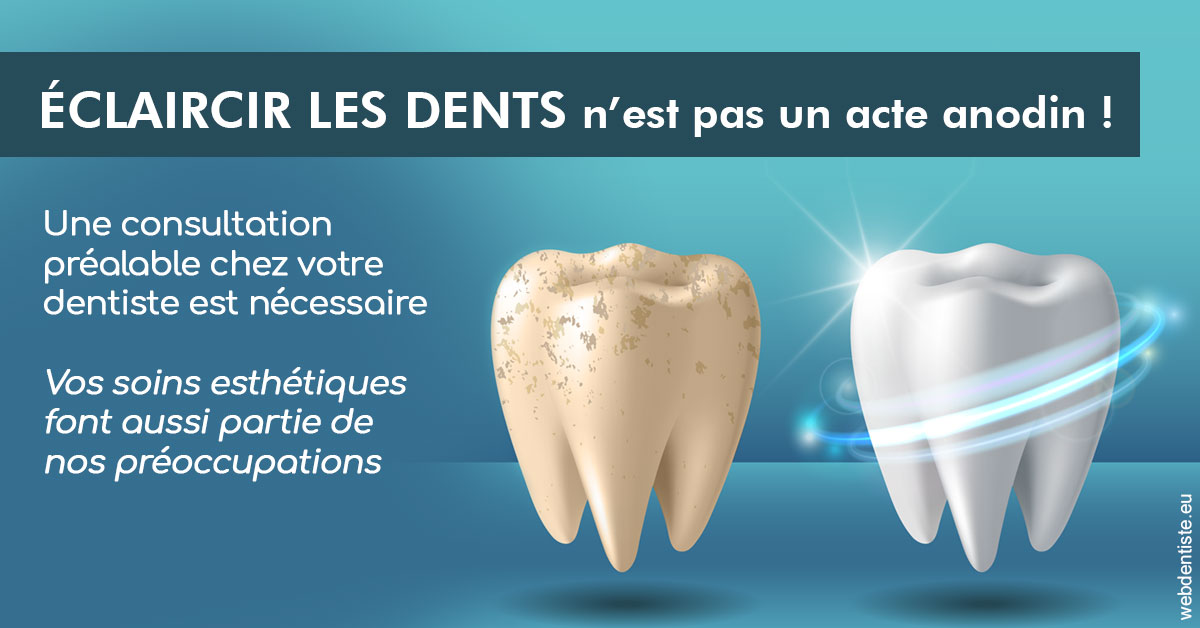 https://dr-carroy-frederic.chirurgiens-dentistes.fr/Eclaircir les dents 2