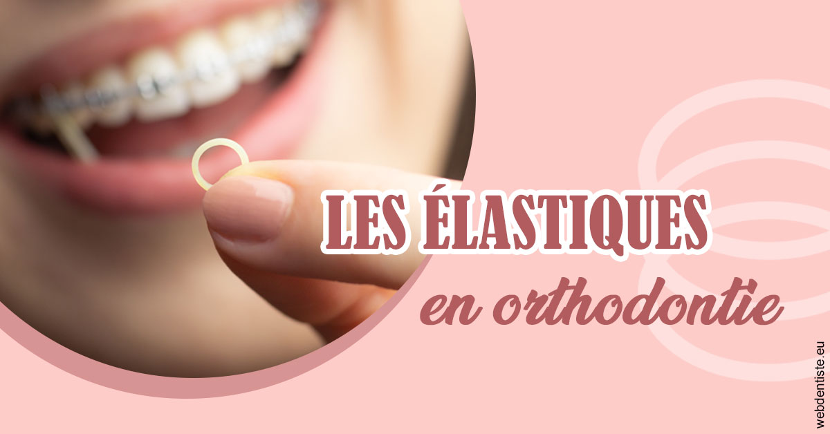 https://dr-carroy-frederic.chirurgiens-dentistes.fr/Elastiques orthodontie 1