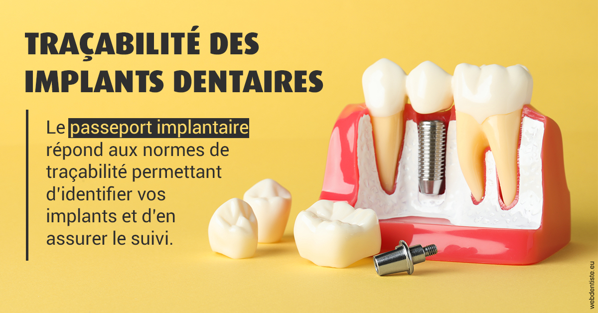 https://dr-carroy-frederic.chirurgiens-dentistes.fr/T2 2023 - Traçabilité des implants 2
