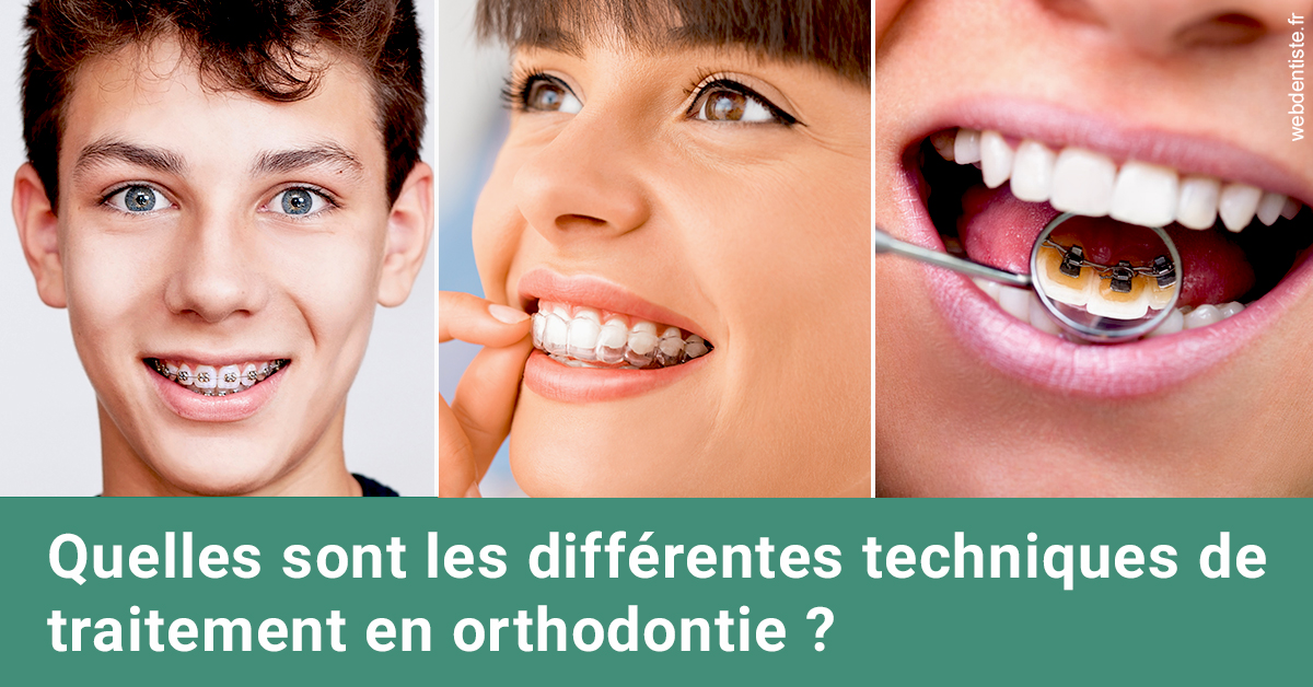 https://dr-carroy-frederic.chirurgiens-dentistes.fr/Les différentes techniques de traitement 2