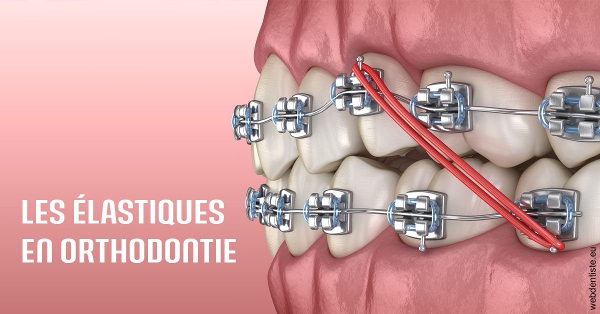 https://dr-carroy-frederic.chirurgiens-dentistes.fr/Elastiques orthodontie 2