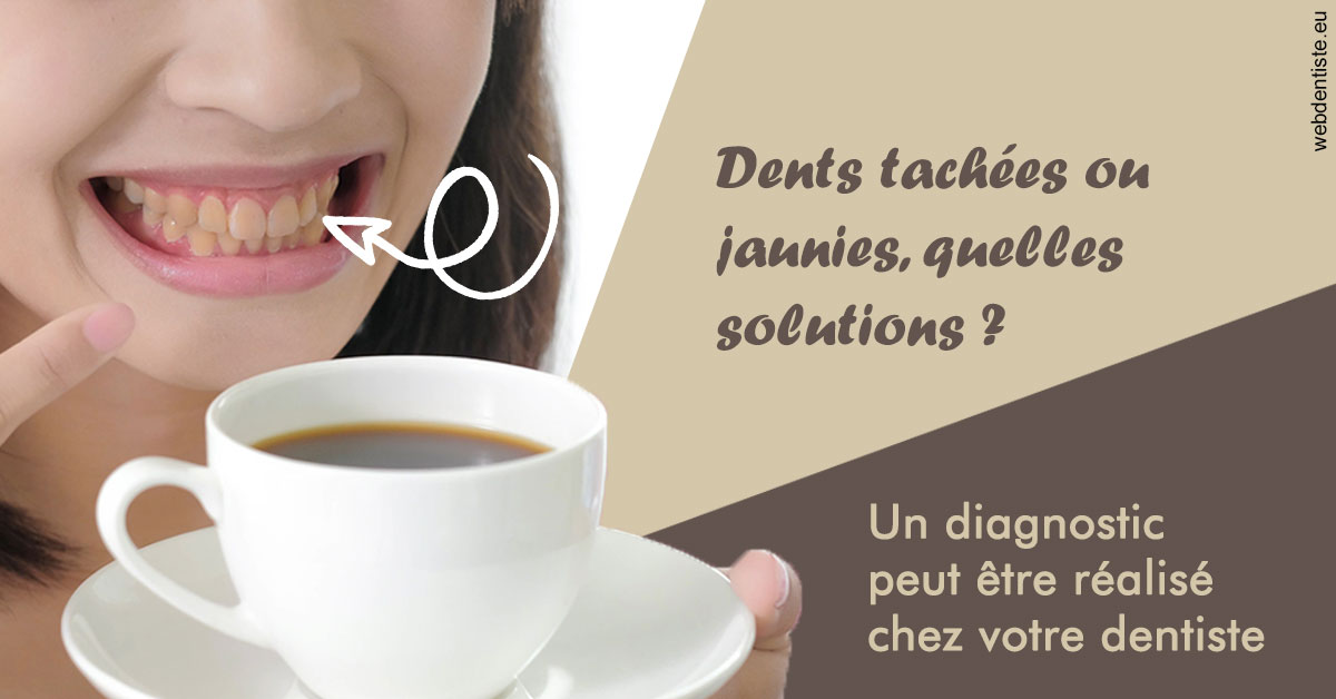 https://dr-carroy-frederic.chirurgiens-dentistes.fr/Dents tachées 1