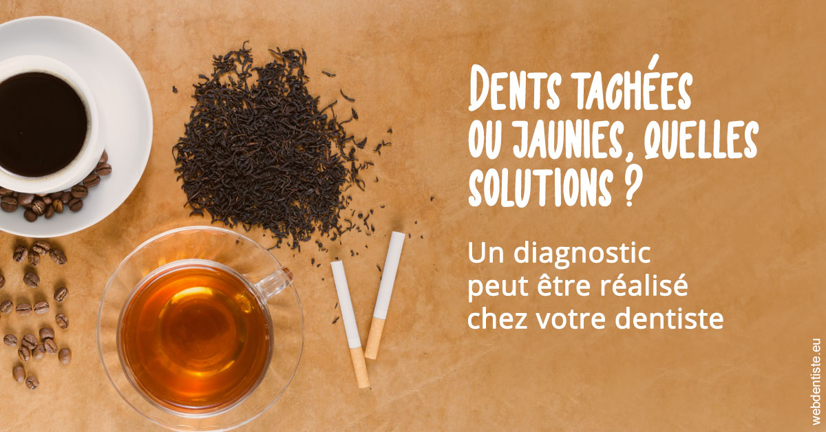 https://dr-carroy-frederic.chirurgiens-dentistes.fr/Dents tachées 2