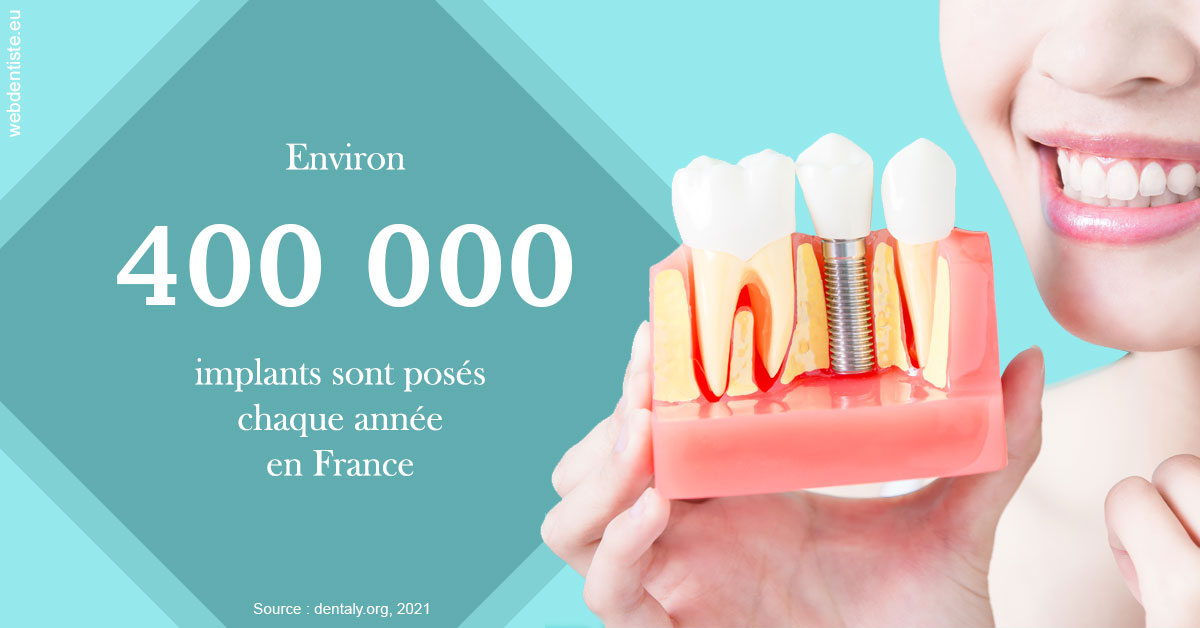 https://dr-carroy-frederic.chirurgiens-dentistes.fr/Pose d'implants en France 2